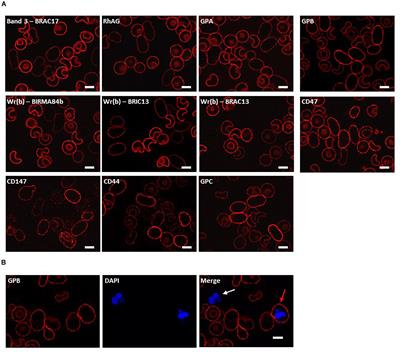 Expression of South East Asian Ovalocytic Band 3 Disrupts Erythroblast Cytokinesis and Reticulocyte Maturation